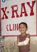 Der Junge mit der Knochemarkentzündung vor dem Röntgeninstitut