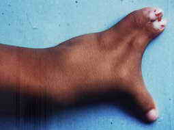 Kadeks linke Hand. (Foto von 1999)