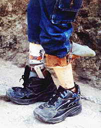 Kadek's new prosthesis with the ordinary shoes